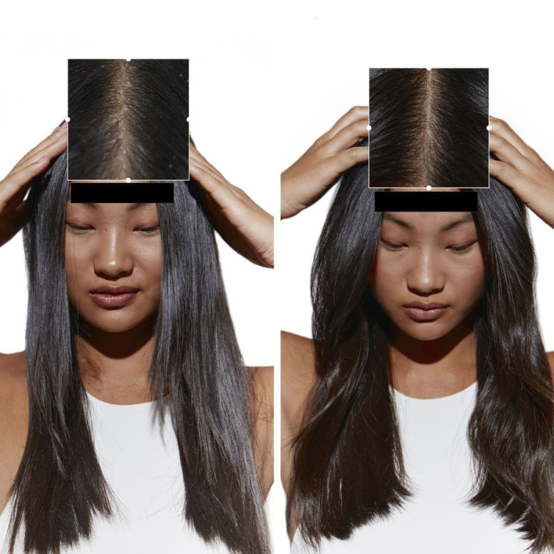 Bain Pureté Anti Pelliculaire 250 ml - Kérastase Symbiose - Keshop.com