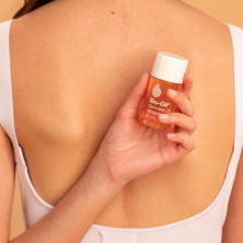 Bio-Oil – Öl für Narben, Dehnungsstreifen und Flecken | Weiche und hydratisierte Haut