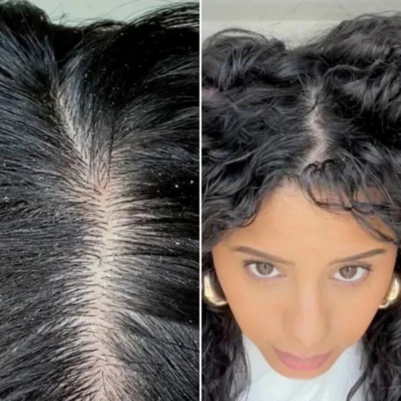 Flora & Curl | Soothe Me Coconut Mint Scalp Mist | Keshop